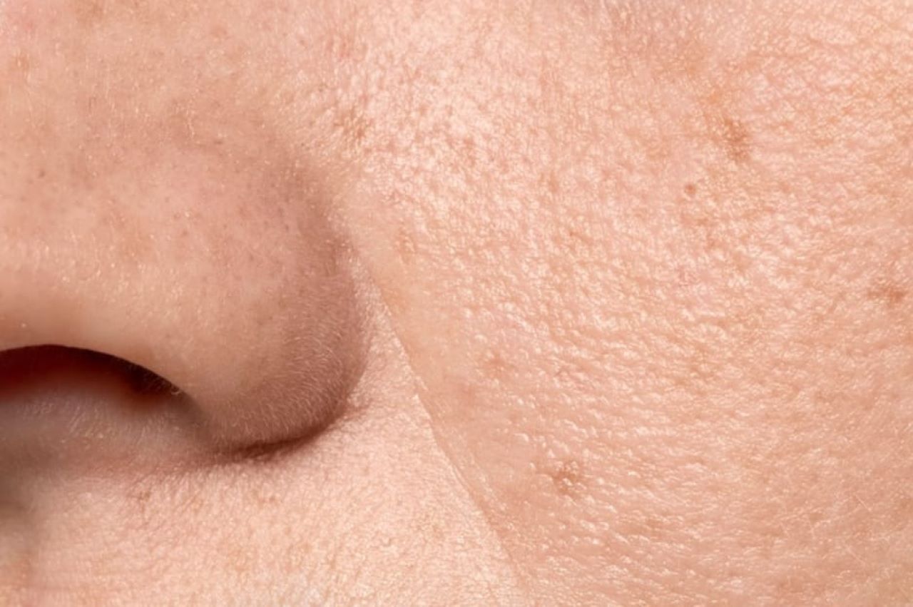 Trik Mengecilkan Pori-Pori Agar Tidak Mudah Tersumbat Cuma Pakai 1 Bahan Alami, Wajah Auto Mulus