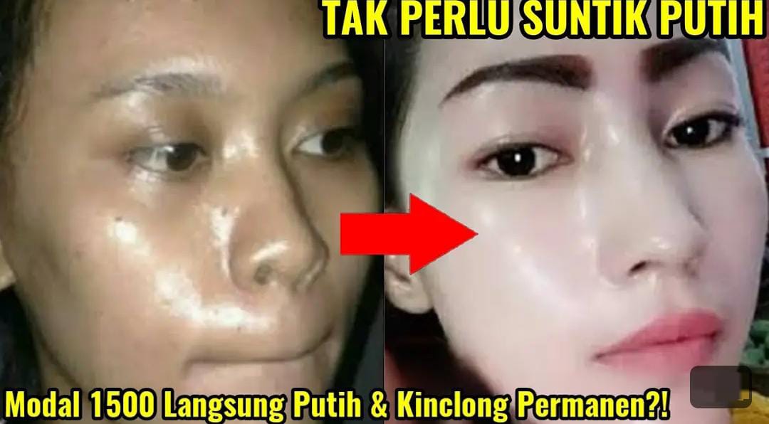 DIY Pemutih Muka dari Bahan Dapur untuk Wajah Glowing, Kulit Langsung Mulus Bebas Flek Hitam Hanya 2 Langkah