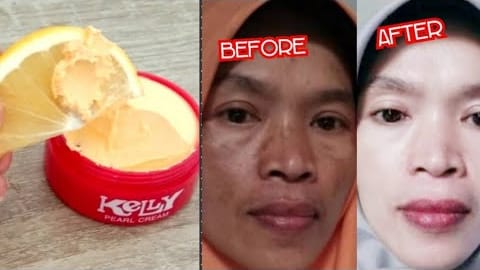 Ini Dia 5 Manfaat Cream Kelly Untuk Flek Hitam, Ampuh Bikin Wajah ...