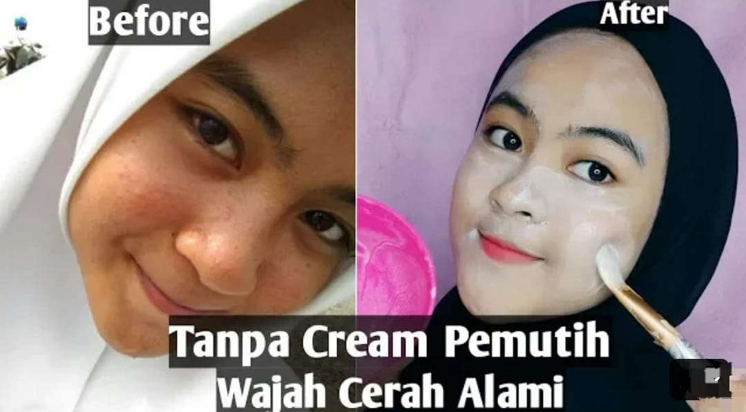 3 Cara Membuat Muka Putih dengan Masker Lidah Buaya, Bikin Flek Hitam Hilang dan Ampuh Kecilkan Pori-Pori