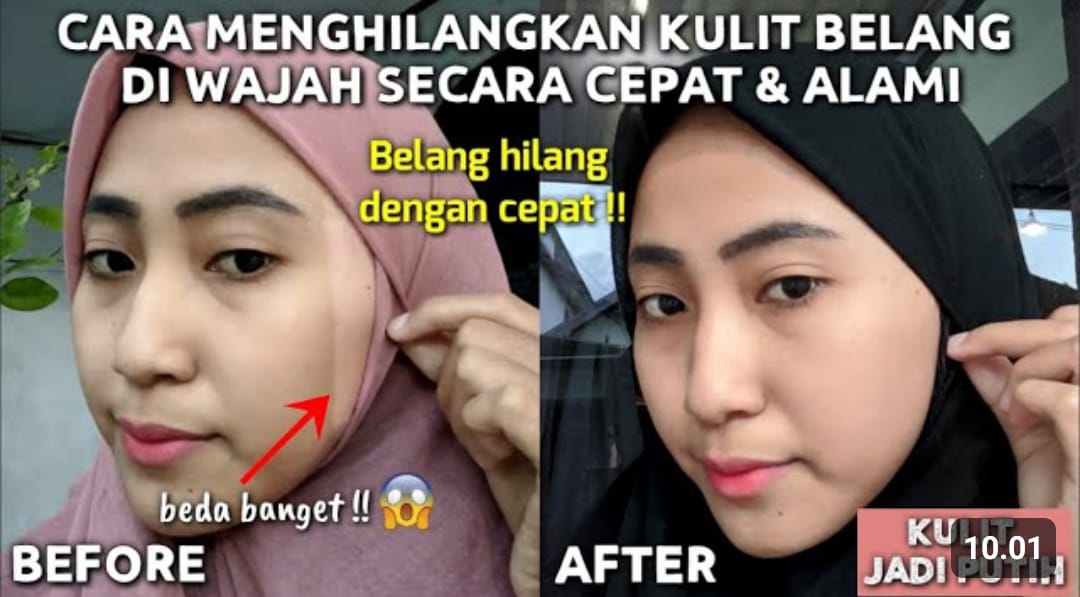 Atasi Wajah Belang Jadi Putih Permanen Dalam Semalam! Ini 3 Petunjuk Meratakan Warna kulit, Cara Anti Gagal