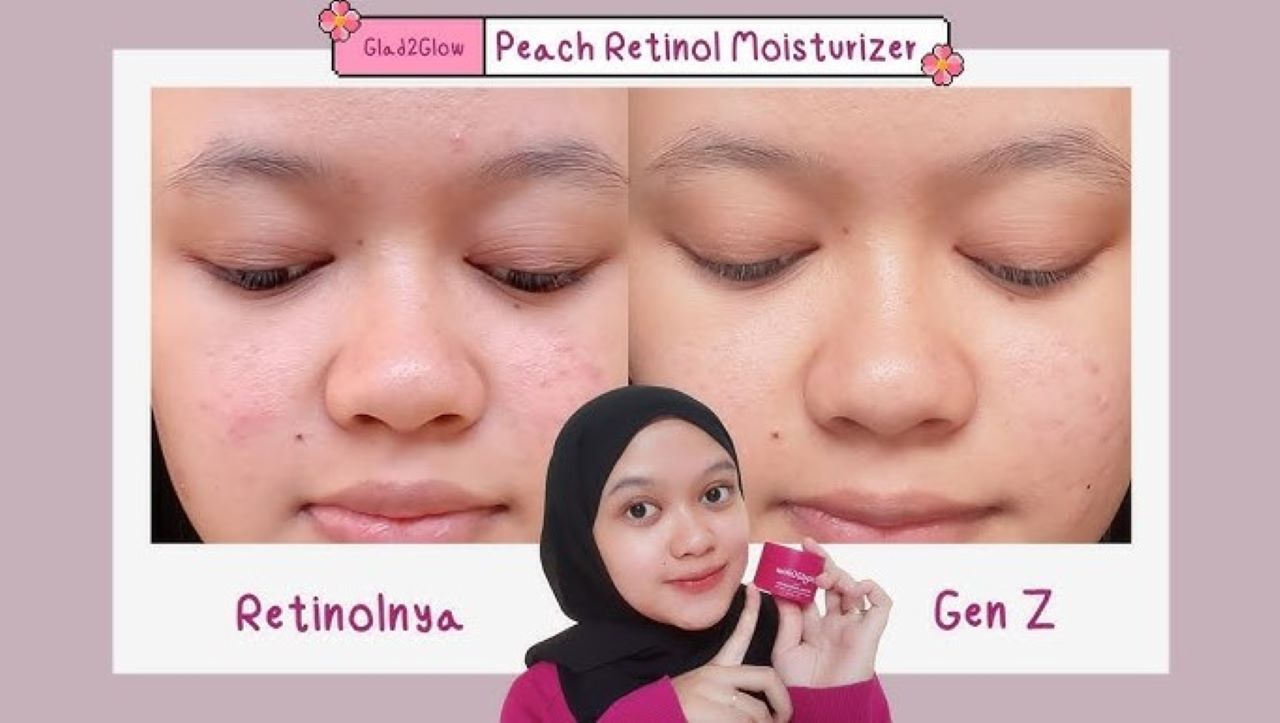 Apakah Moisturizer Retinol untuk Mengurangi Tanda Penuaan Pilihanmu Sudah Tepat? Ini 3 Rekomendasinya 