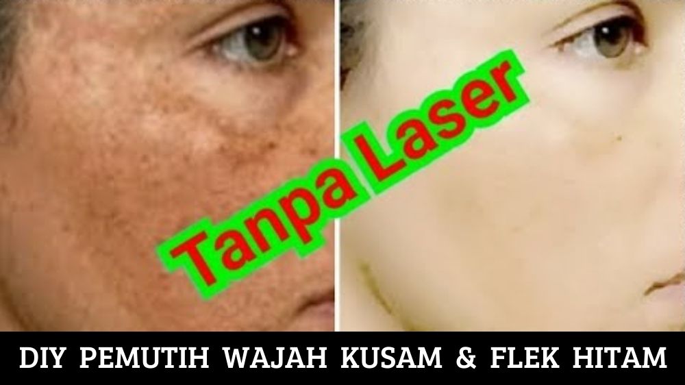 DIY Pemutih Wajah Kusam dan Flek Hitam, Glowing dalam 15 Menit dari Skincare Alami Racikan Sendiri