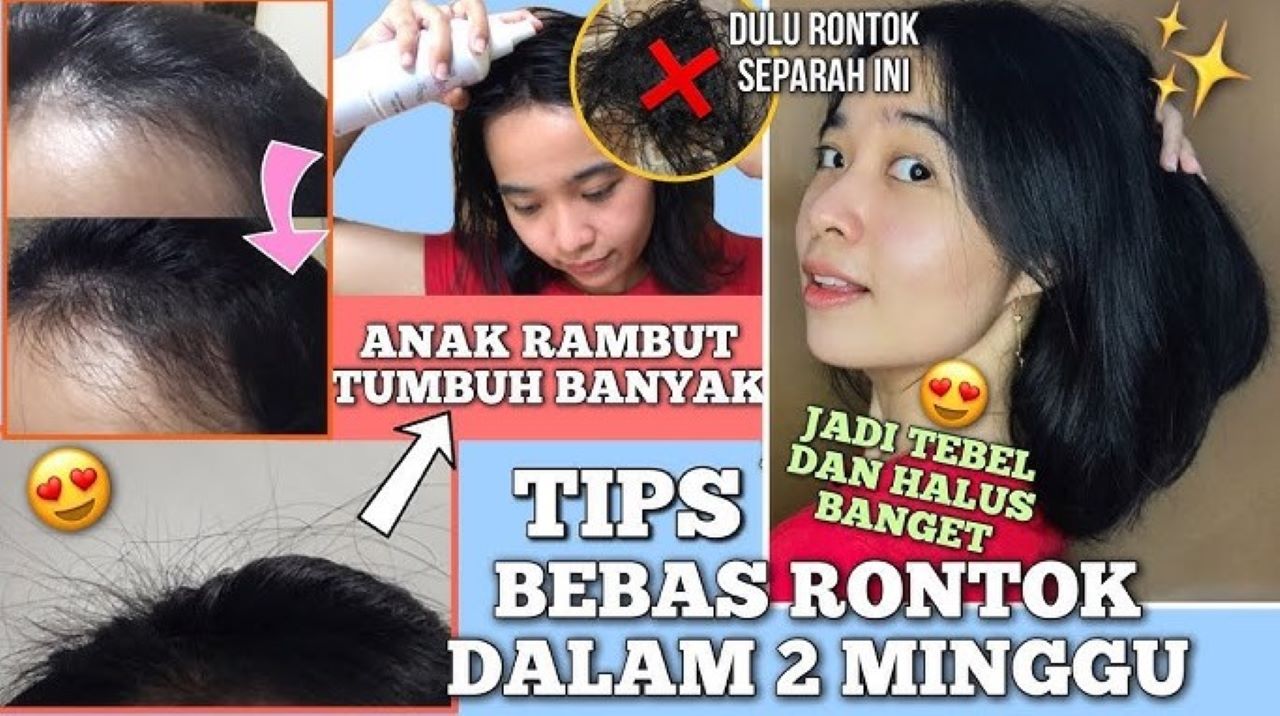 5 Shampo untuk Menumbuhkan Rambut Agar Lebat dan Tidak Mudah Rontok Lagi 