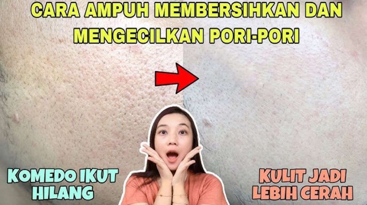 Beauty Hack Membersihkan Pori-Pori Agar Tampilannya Mengecil dengan 1 Bahan Alami Saja