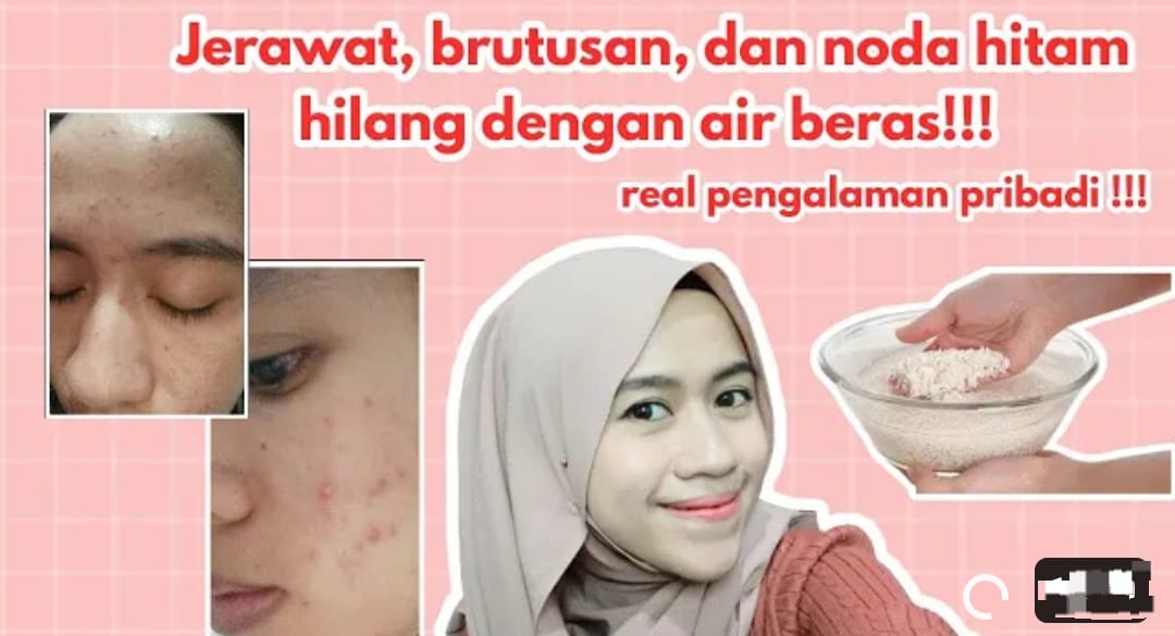 Begini Cara Menggunakan Air Cucian Beras untuk Memutihkan Wajah dan Hilangkan Flek Hitam, Kulit Mulus Permanen