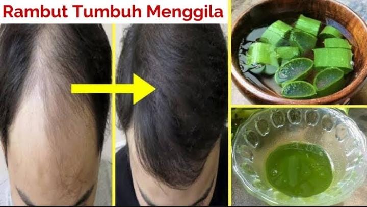 2 Cara Menebalkan Rambut Tipis Pakai Bahan Alami, Rahasia Atasi Botak dan Rambut Rontok Tanpa Haircare Mahal