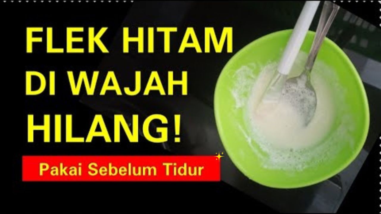 Inilah Cara Menghilangkan Flek Hitam di Wajah Tanpa Biaya, Cukup 2X Seminggu Wajah Kembali Glowing