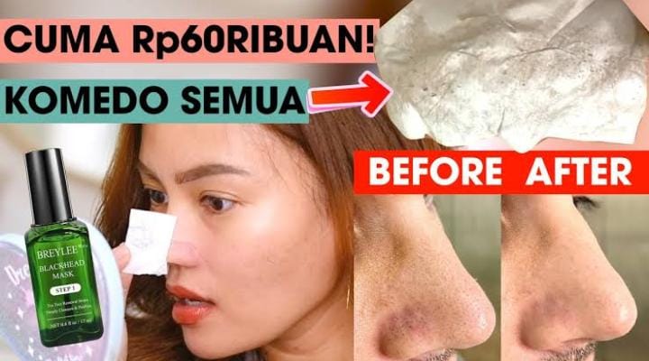 6 Merk Masker Penghilang Komedo Terbaik, Ampuh Kecilkan Pori-Pori Bikin Kulit Mulus dan Lembut