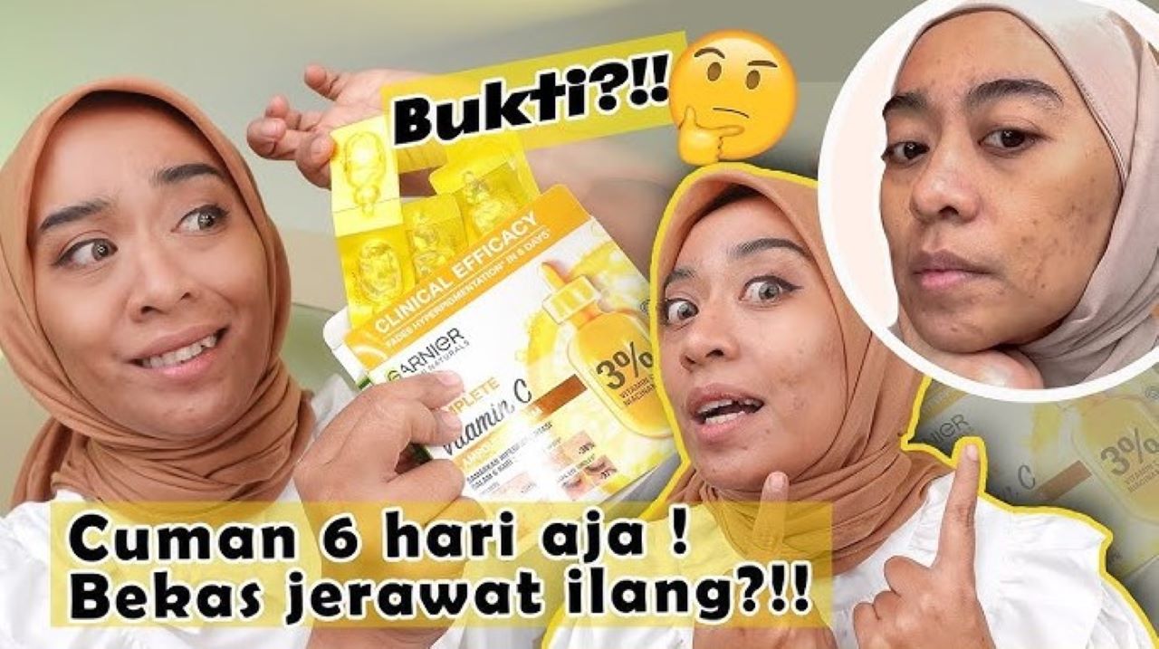 4 Produk Garnier yang Pudarkan Flek Hitam dengan Cepat, Wajah Glowing dan Mulus Awet Muda