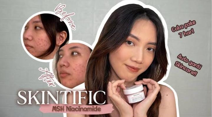 Krim Niacinamide Efektif Menghilangkan Flek Hitam dan Mencerahkan Wajah, Berikut Rekomendasi Produk Terbaiknya