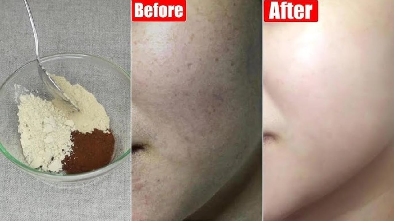 3 DIY Masker Kopi Pengecil Pori-Pori Terbuka, Wajah Glowing dan Mulus Tanpa Flek Hitam 