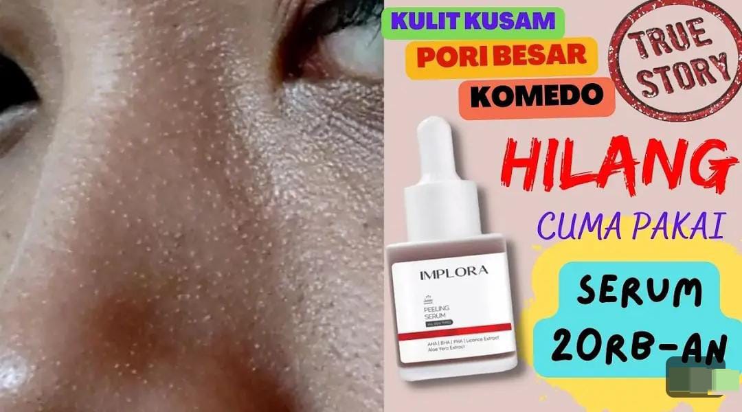 4 Serum untuk Wajah Glowing Usia 40 Tahun Ke Atas, Kulit jadi Kencang Tampak Awet Muda Dengan Modal 30 Ribuan