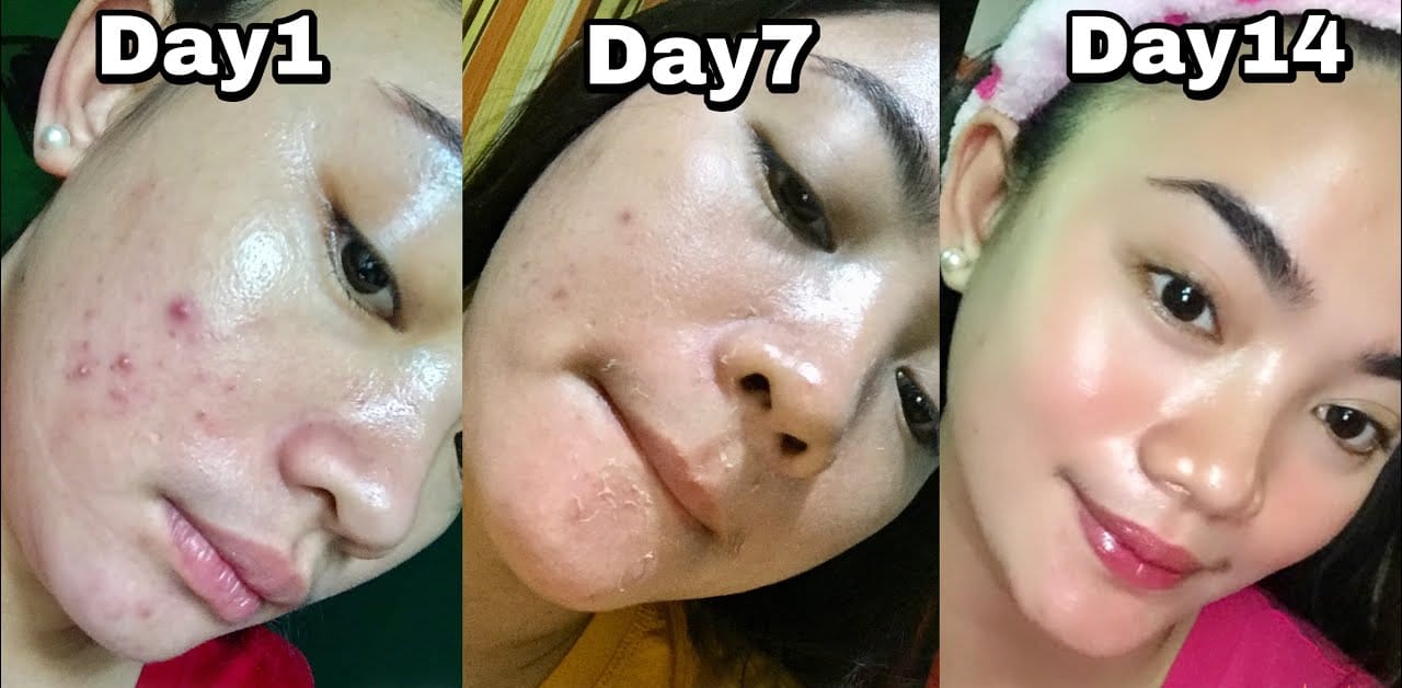 Ini Dia 5 Buah dan Sayur yang Mengandung Kolagen Tinggi, Bikin Kulit Glowing Awet Muda Bebas Kerutan dan Noda