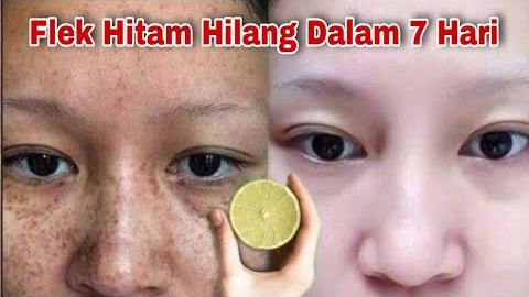 2 Cara Pakai Jeruk Nipis untuk Wajah Kusam dan Flek Hitam, Cuma Modal 1 Bahan Bisa Bikin Skincare di Rumah