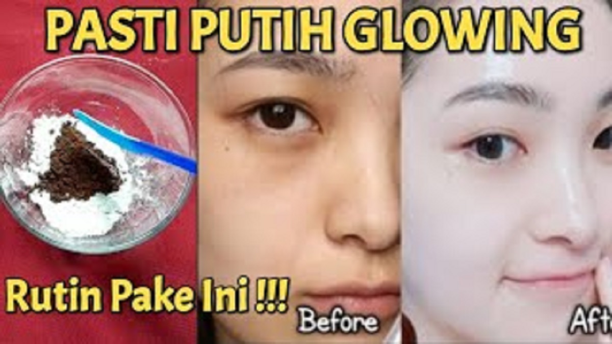 4 Cara Mudah Memutihkan Flek Hitam dan Bekas Jerawat Pakai Bahan Dapur, Bonus Glowing Permanen