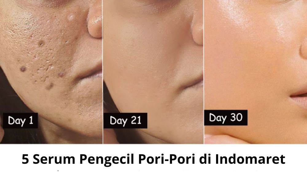 5 Serum Pengecil Pori-Pori di Indomaret, Cocok untuk Usia 40 Tahun ke Atas Agar Glowing dan Mulus Awet Muda