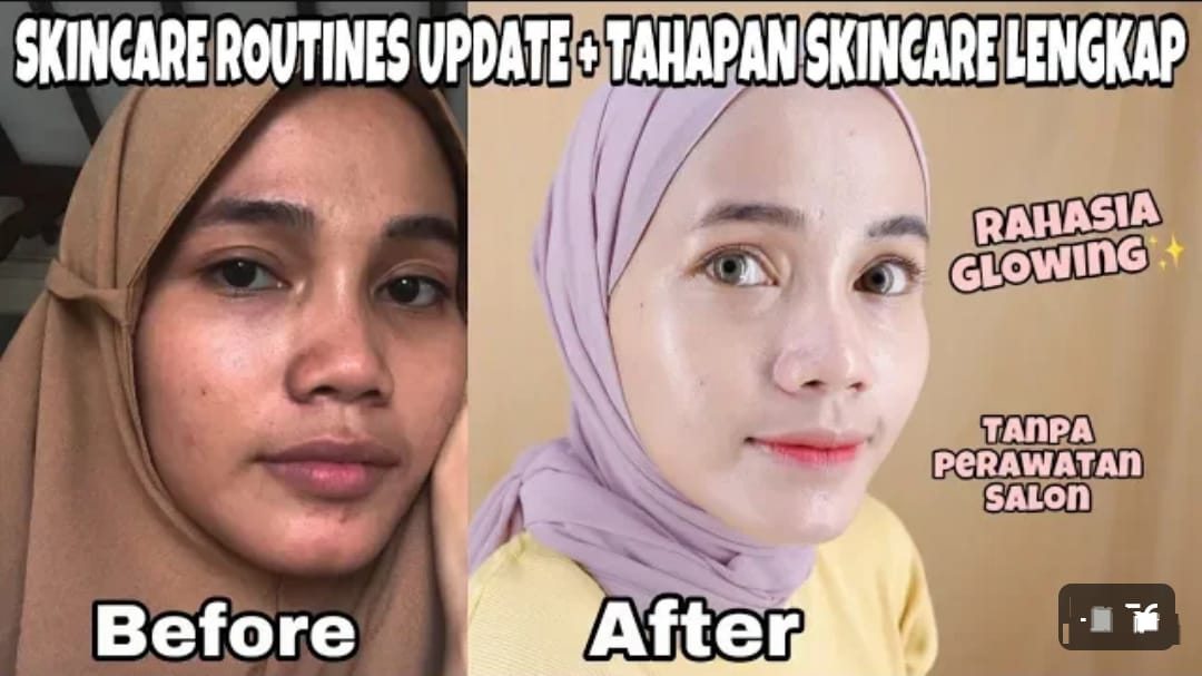 3 Daftar Skincare Bpom Murah untuk Memutihkan Wajah, Bantu Hilangkan Noda Hitam dan Bikin Wajah Bebas Kilap