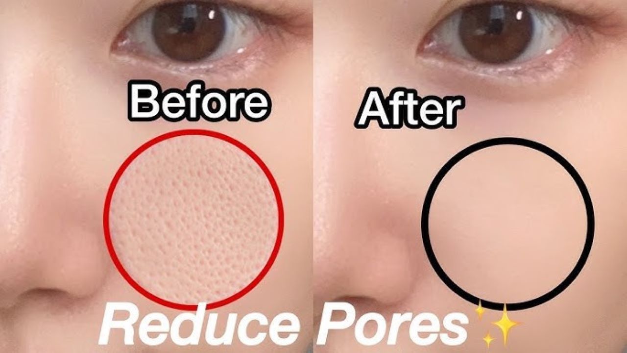 4 Serum Pengecil Pori-Pori yang Terbuka, Bikin Wajah Mulus dan Glowing