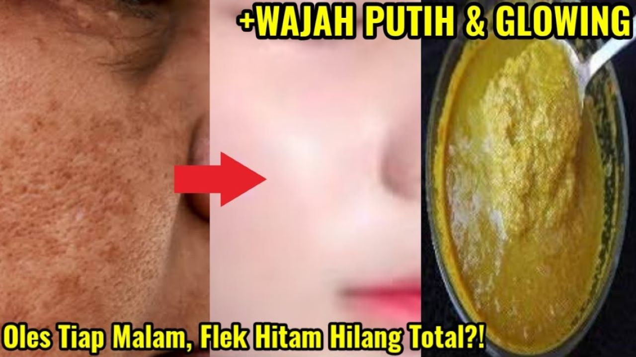 DIY Masker Pemutih Wajah dan Flek Hitam, Gunakan 3 Bahan Alami Ini Saja