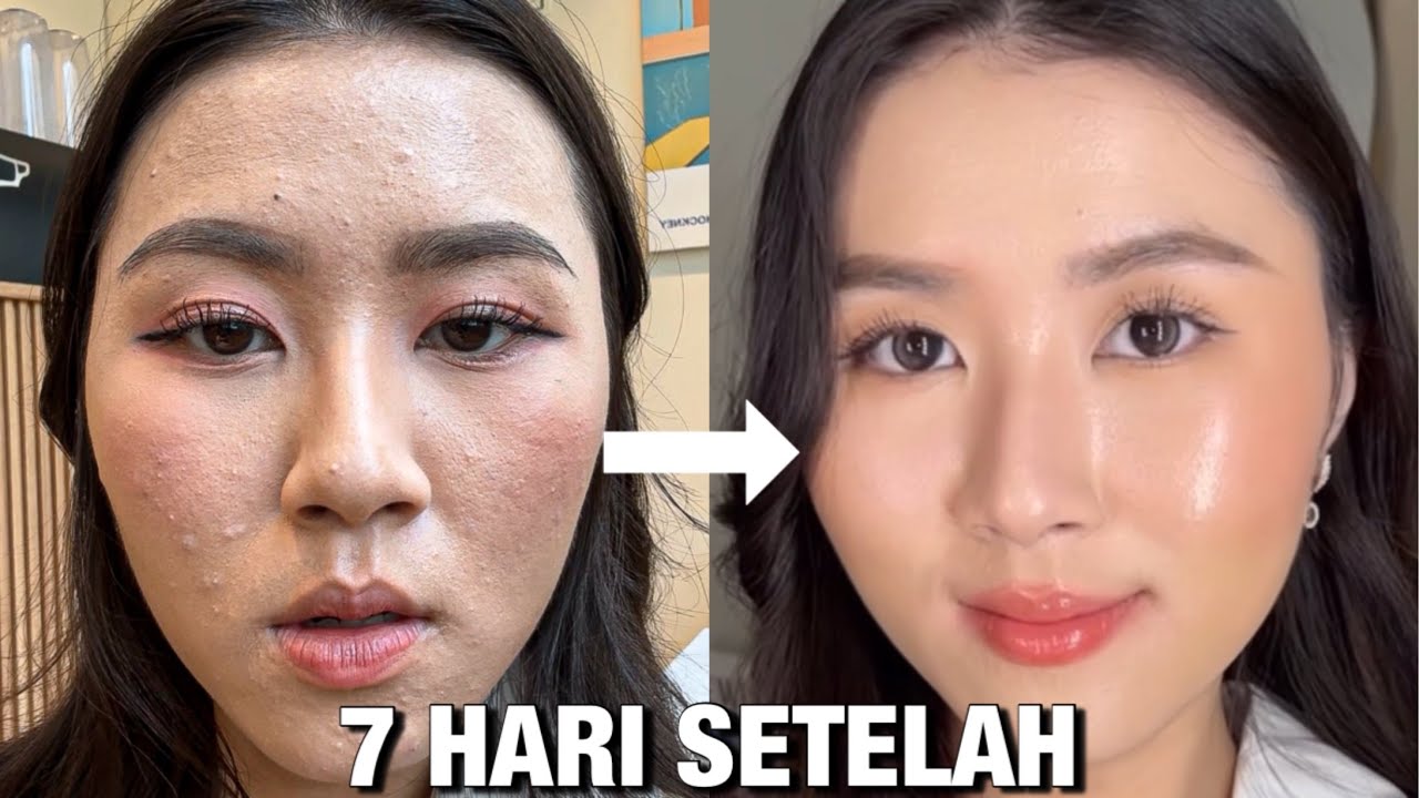 5 Rekomendasi Skincare yang Bagus untuk Kulit Kering dan Kusam Saat Puasa