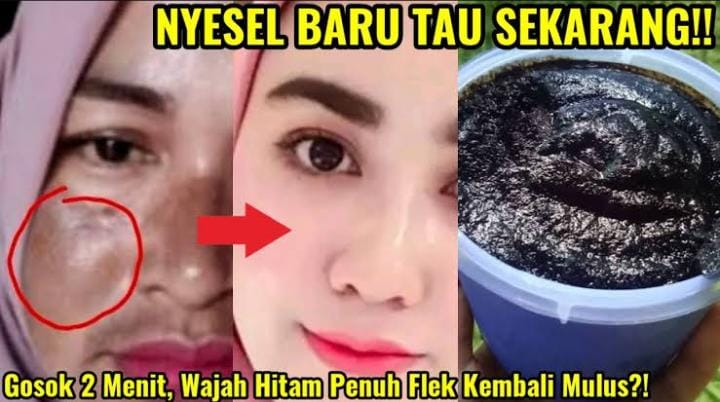 Bye Kulit Kusam, Begini Cara Memutihkan Wajah dengan 2 Bahan Dapur yang Bikin Glowing dan Awet Muda