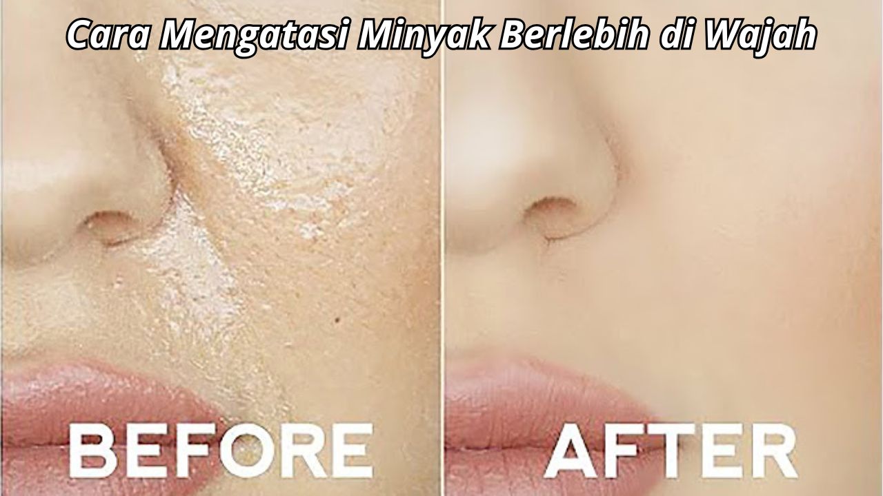 Bagaimana Cara Mengatasi Minyak Berlebih di Wajah? Gunakan 2 Jenis Buah Ini