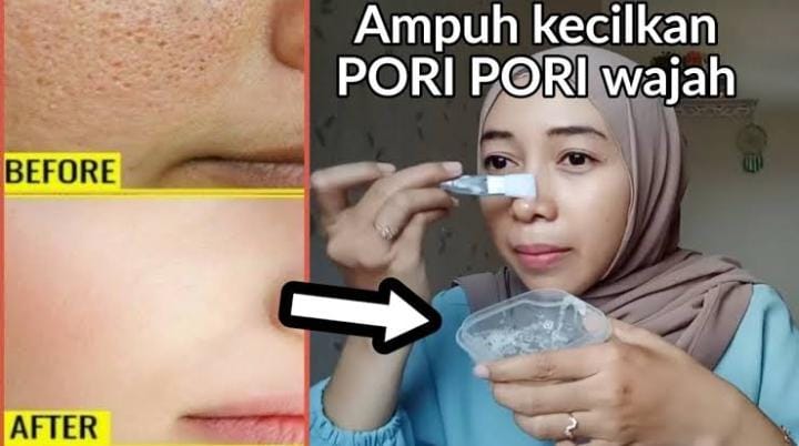4 cara mengecilkan pori-pori wajah dengan bahan alami, menghaluskan dan mencerahkan wajah menggunakan perawatan kulit rumahan
