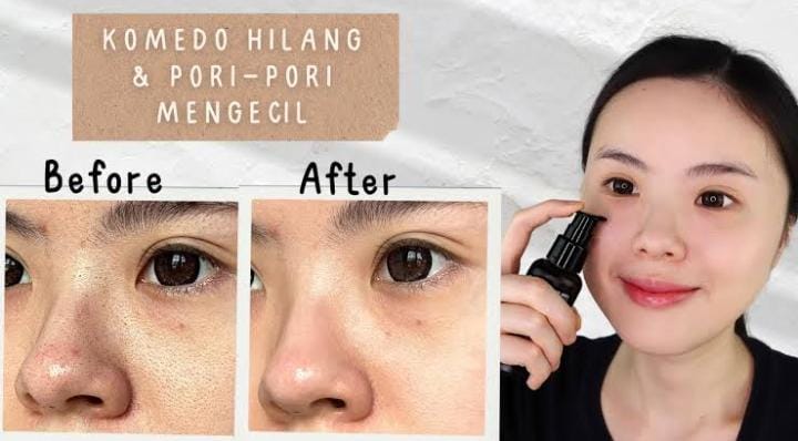 4 Pilihan Toner Terbaik untuk Mengecilkan Pori-Pori, Efektif Bikin Wajah Mulus dan Bebas Komedo