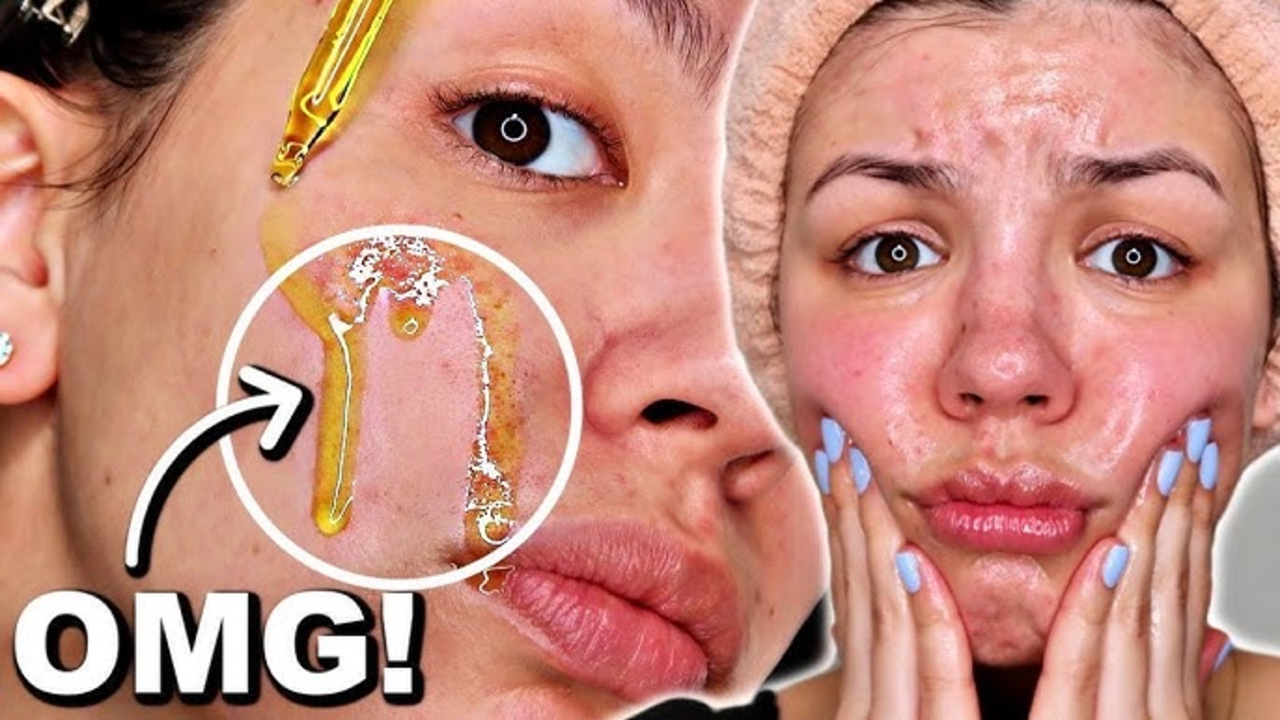 5 Cleansing Oil untuk Komedo dan Pori-Pori Besar Terbaik 2025