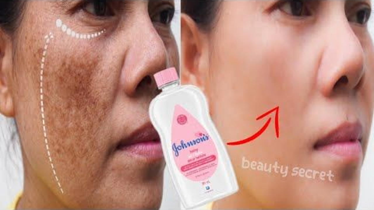 DIY Masker Baby Oil Pengelupas Flek Hitam dalam 1 Malam, Cukup Tambahkan 1 Bahan Ini Wajah Jadi Glowing