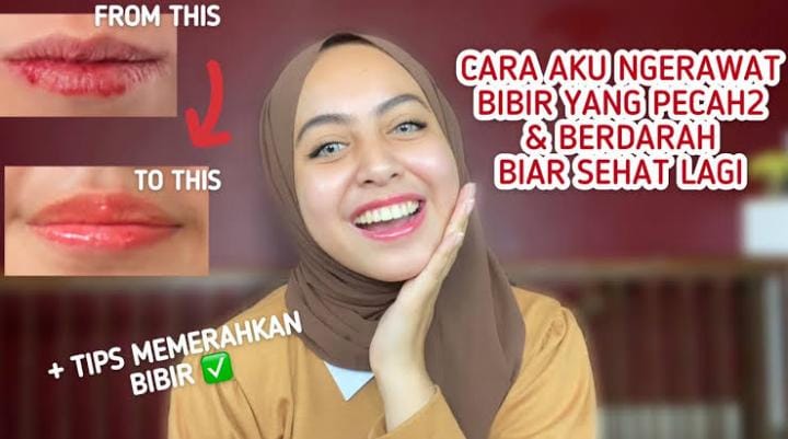 2 Bahan Dapur untuk Mengatasi Bibir Kering dan Pecah-Pecah, Tips Alami Punya Bibir Kenyal dan Lembap