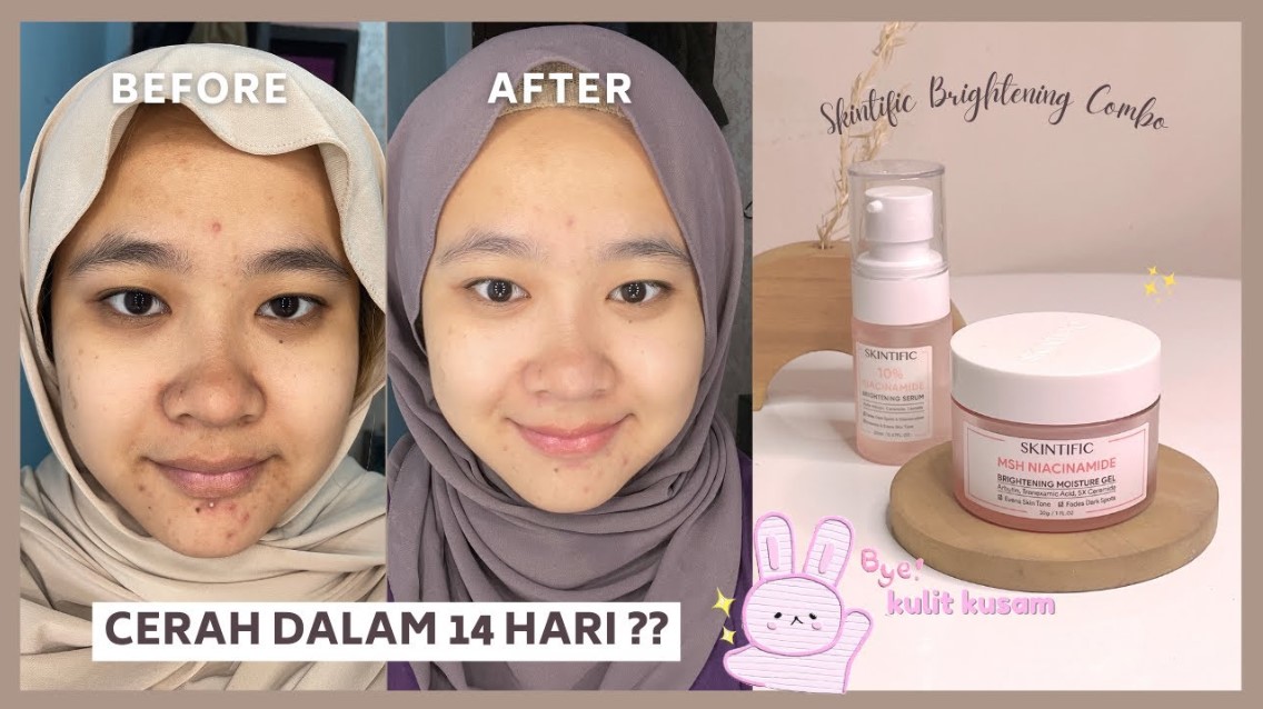 4 Produk Skintific untuk Kulit Cerah dan Glowing, Solusi Atasi Wajah Kusam