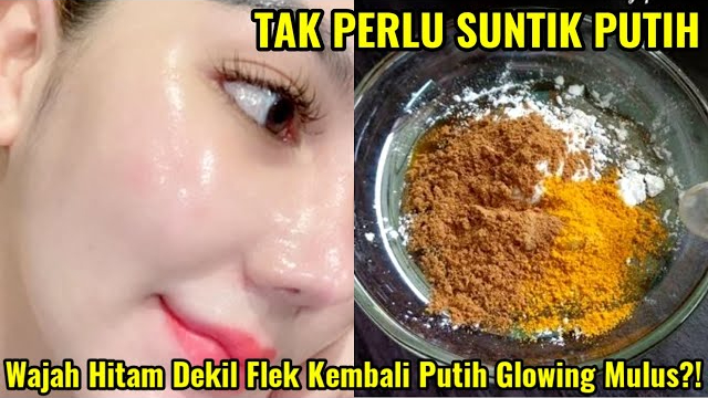 2 Cara Pakai Kunyit Untuk Menghilangkan Flek Hitam Membandel Wajah