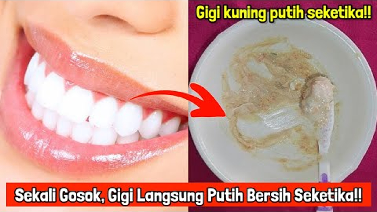 3 Cara Menghilangkan Gigi Kuning yang Sudah Lama Secara Alami