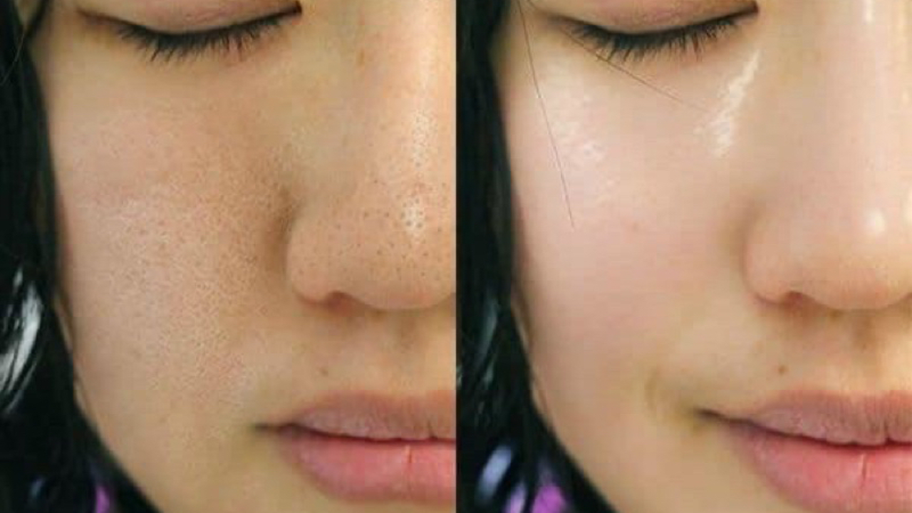 5 Skincare untuk Pori-Pori Besar dan Kusam di Bawah 50 Ribuan, Kulit Auto Mulus!