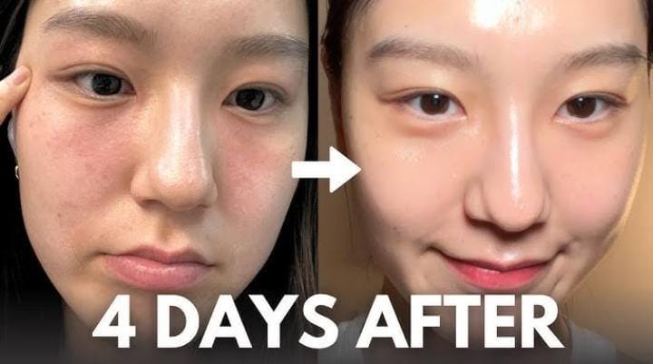 Bye Tanda Penuaan! Inilah 4 Moisturizer Korea untuk Kulit Kering dan Kusam, Bikin Wajah Cerah Lembap Seharian