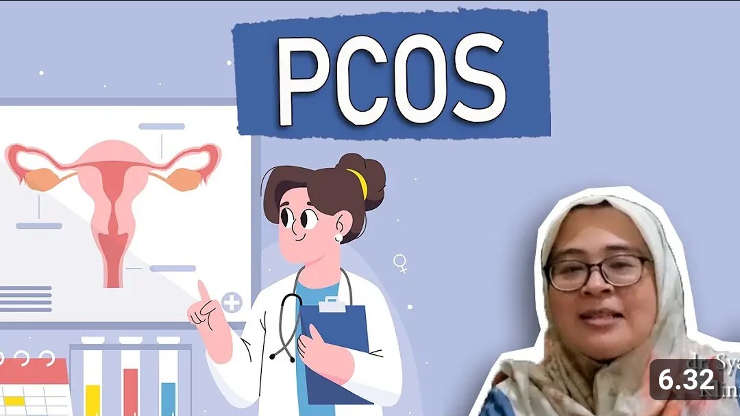 Begini 4 Cara Mengetahui PCOS pada Wanita Selain Menggunakan Alat USG