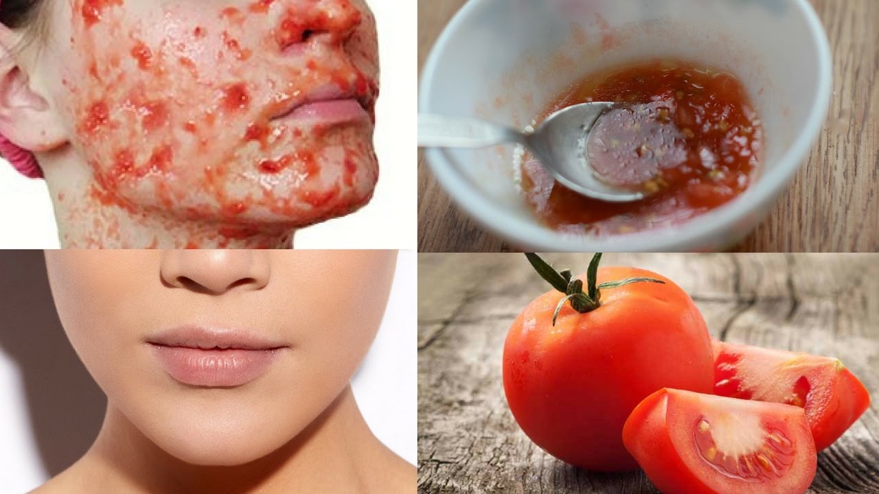 Inilah 3 Cara membuat Masker Tomat untuk Memutihkan Wajah Dalam 1 Hari, Bantu Usir Flek dan Kecilkan Pori-Pori
