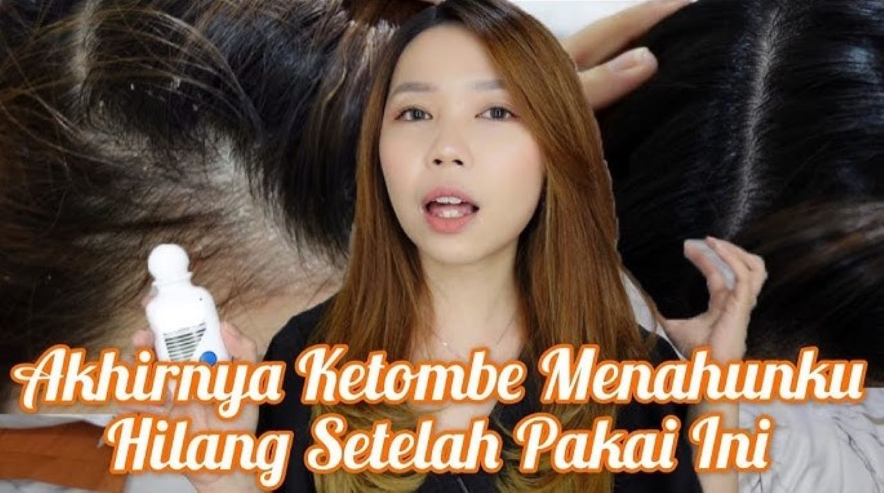Racikan Shampo untuk Mengatasi Ketombe Membandel, Cukup Tambahkan 1 Bahan Ini Saja 