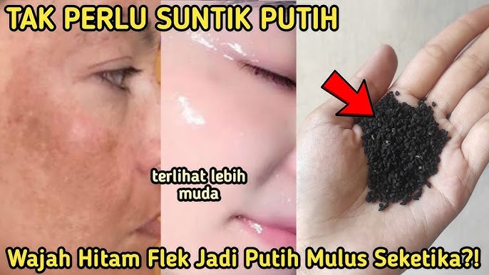 DIY Masker Teh untuk Mengelupas Flek Hitam dalam 1 Malam, Begini Cara Buatnya