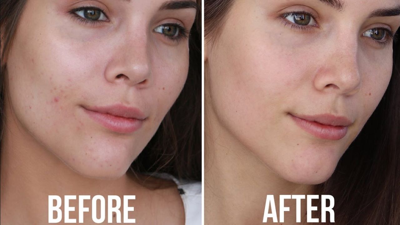 Begini Cara Agar Wajah Bebas Minyak Berlebih, Bonus Pori-Pori Mengecil Kulit Jadi Mulus