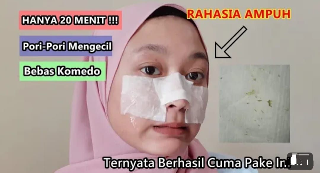 4 Cara Instan Mengecilkan Pori-Pori Secara Alami Bikin Putih dan Glowing Permanen, Efektif Pudarkan Noda Hitam