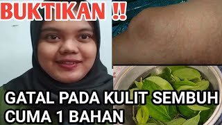 Ingin Sembuh dari Penyakit Kulit? Inilah 3 Manfaat Daun Sirih Merah untuk Penyakit Kulit