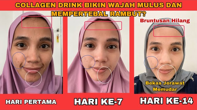 3 Manfaat Minuman Kolagen untuk Kecantikan dan Rekomendasi Produk Terbaiknya, Bikin Kulit Glowing Awet Muda