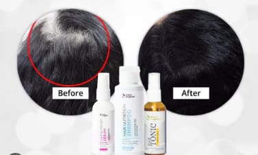 3 Minyak Rambut Penghilang Uban untuk Usia 40 Tahun Ke Atas, Rambut Hitam Permanen dalam Sekali Usap