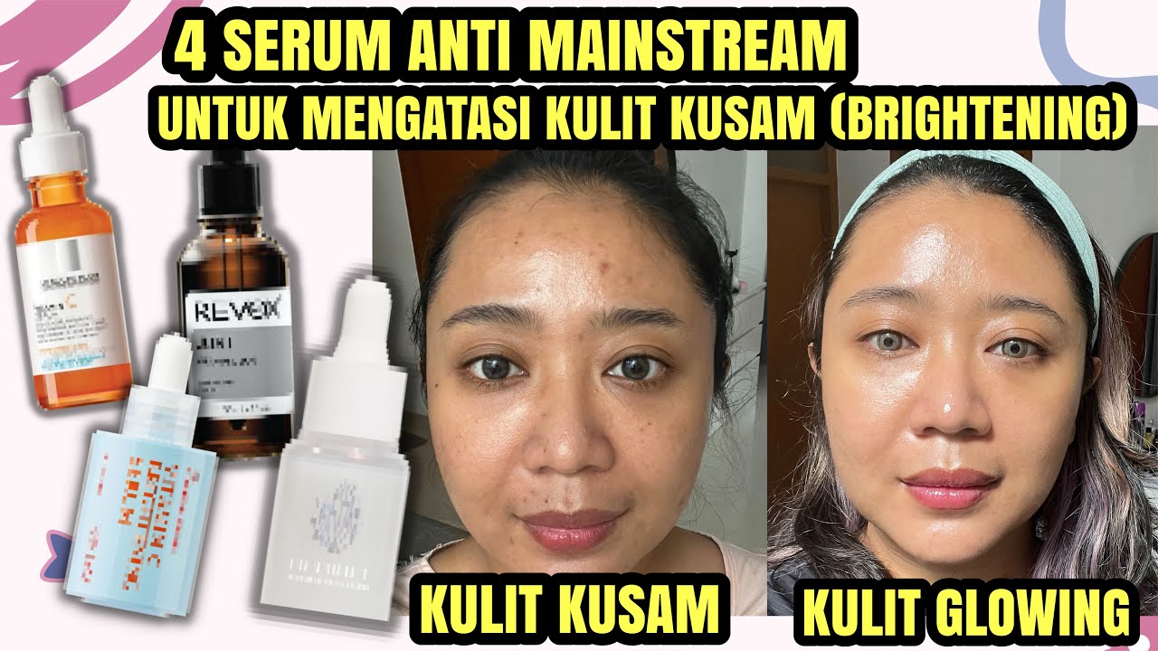 4 Serum Niacinamide untuk Wajah Kusam dan Kering, Rahasia Glowing Bebas Flek Hitam di Usia 30 Tahun Ke Atas