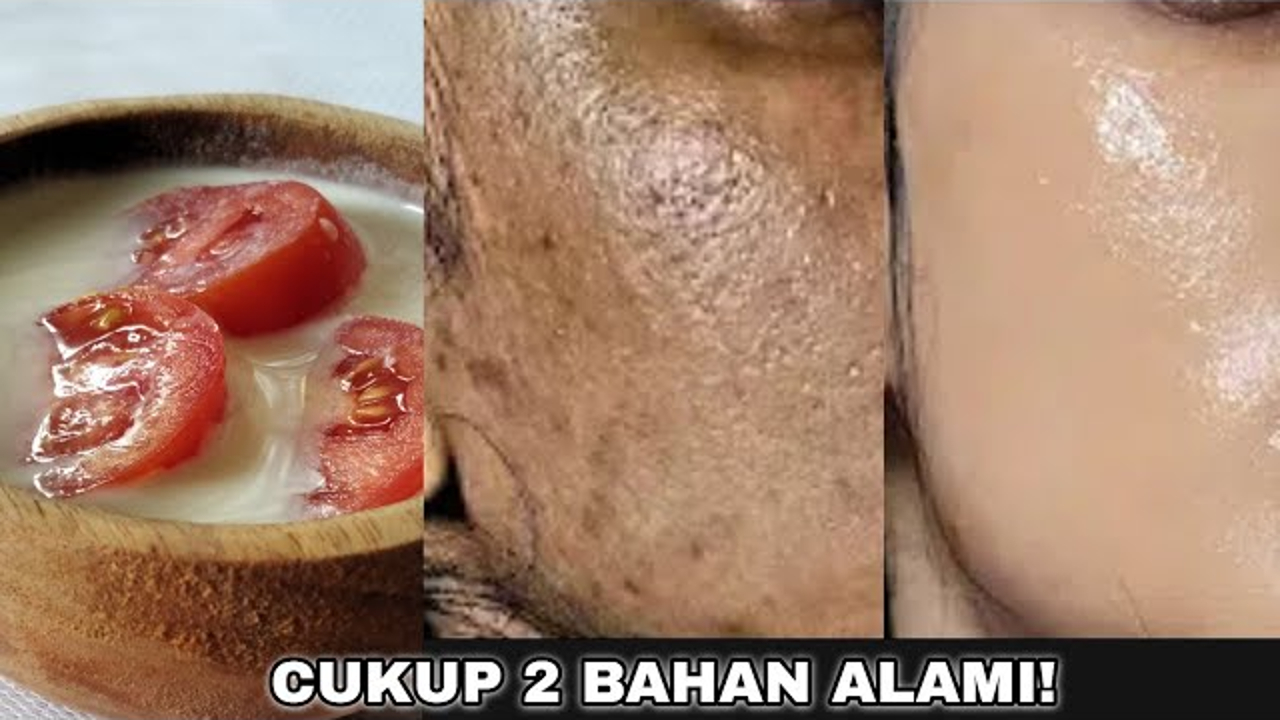 Tips Mengelupas Flek Hitam dalam 1 Malam dengan Masker Tomat, Begini Cara Meraciknya