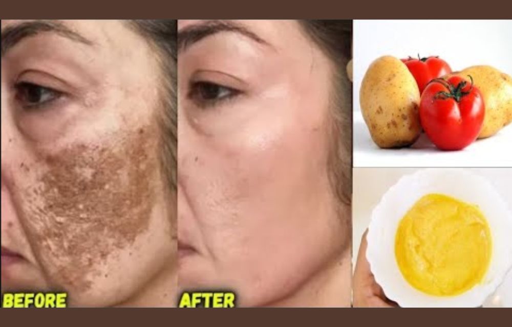 DIY Masker Pemutih Wajah Alami, Hanya Modal 3 Bahan Rumahan Bikin Kulit Cerah Tanpa Noda Hitam