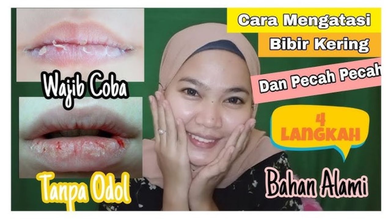 Ternyata Gula Pasir Bisa Mengatasi Bibir Kering dan Pecah-Pecah, Begini Caranya 